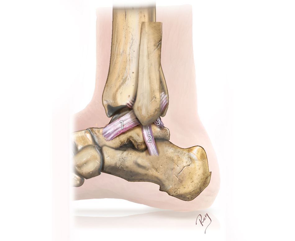 Ligaments externes de la cheville