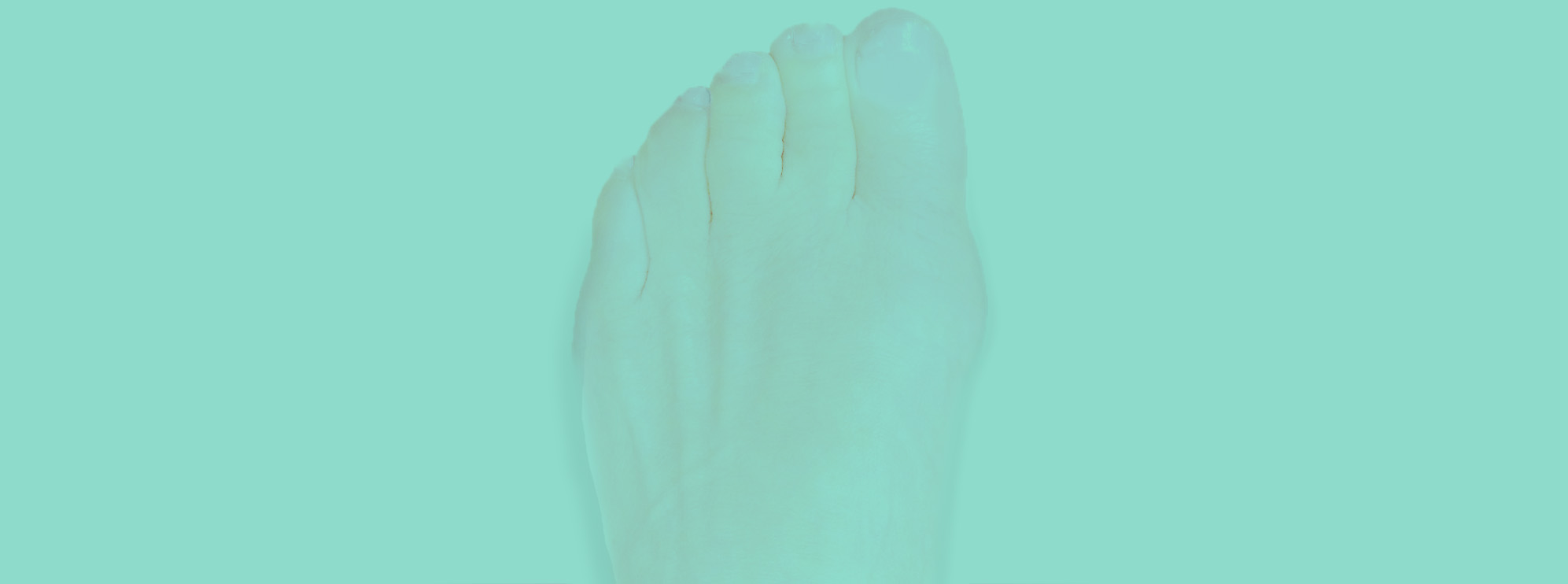 Hallux Rigidus Genève