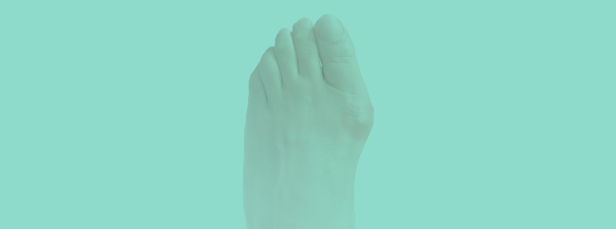 Hallux Valgus Genève