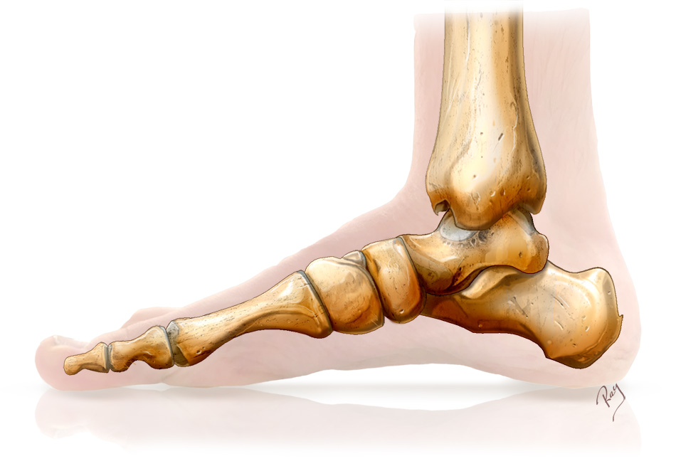 1950s Anatomical Teaching Model Of Normal Size Depicting Flat Foot Pes ...